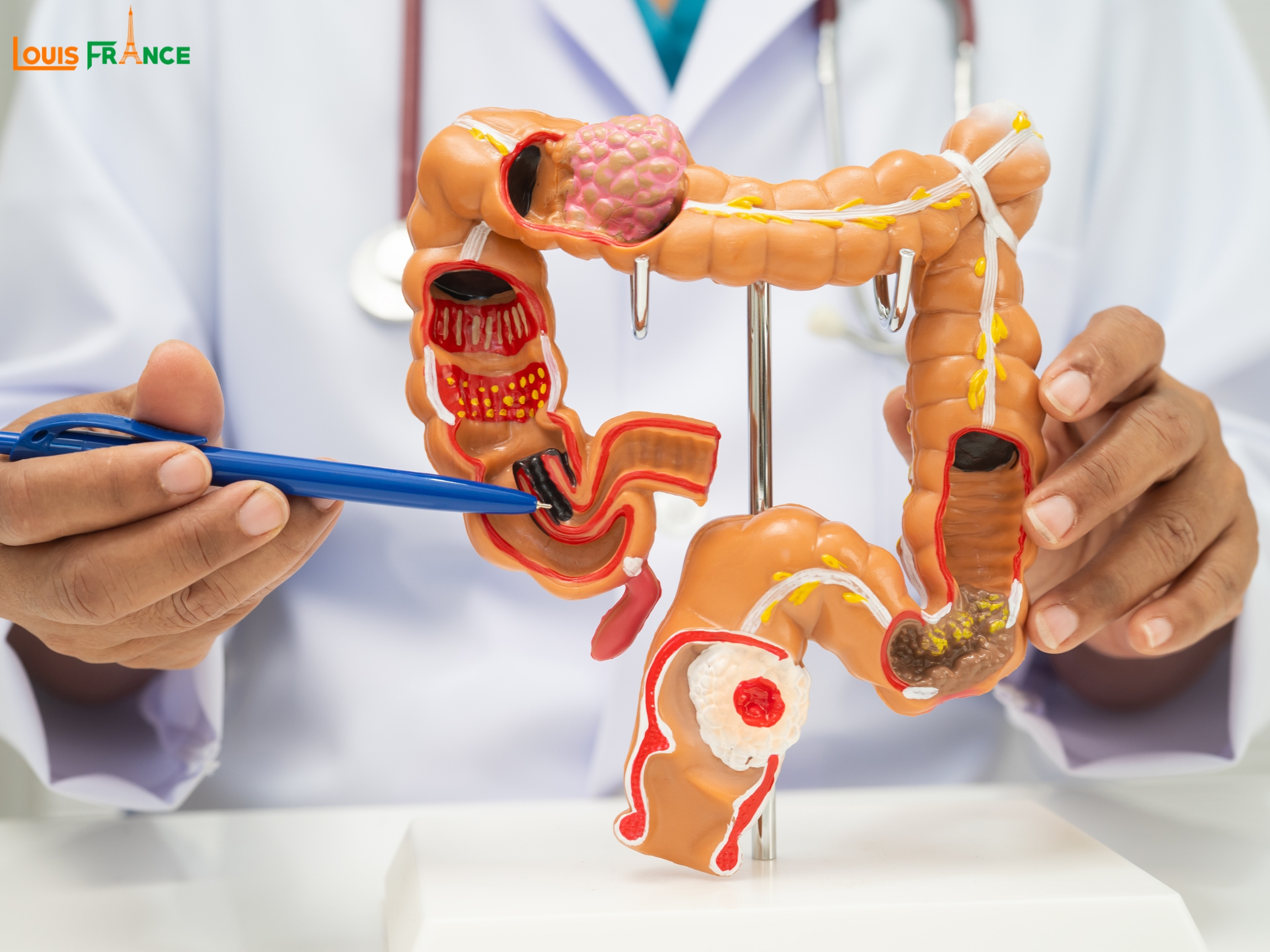 Nhiễm khuẩn tiêu hoá